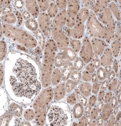 TCF21 Polyclonal Antibody, Invitrogen 100 &mu;L; Unconjugated:Antistoffer