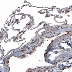 TCF21 Polyclonal Antibody, Invitrogen 100 &mu;L; Unconjugated:Antistoffer