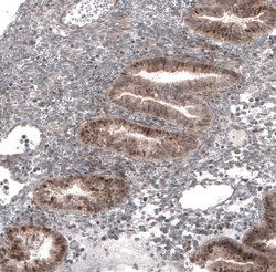 TCF21 Polyclonal Antibody, Invitrogen 100 &mu;L; Unconjugated:Antistoffer