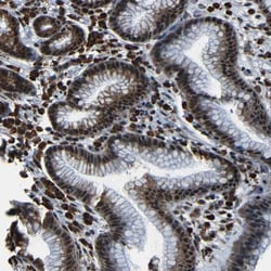Invitrogen C17orf85 Polyclonal Antibody 100 &mu;L; Unconjugated:Antibodies,