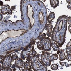 Invitrogen POMK Polyclonal Antibody 100 &mu;L; Unconjugated:Antibodies,