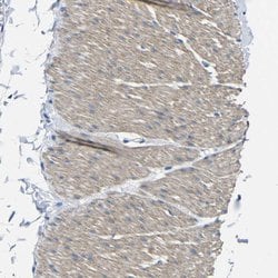Invitrogen TNFAIP1 Polyclonal Antibody 100 &mu;L; Unconjugated:Antibodies,