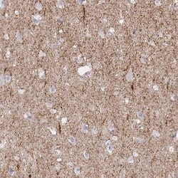 Invitrogen SLC6A1 Polyclonal Antibody 100 &mu;L; Unconjugated:Antibodies,