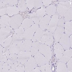 Invitrogen SLC6A1 Polyclonal Antibody 100 &mu;L; Unconjugated:Antibodies,