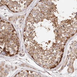 Invitrogen PTPN22 Polyclonal Antibody 100 &mu;L; Unconjugated:Antibodies,