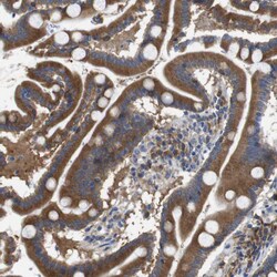 Invitrogen DDRGK1 Polyclonal Antibody 100 μL; Unconjugated:Antibodies,