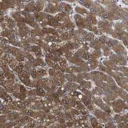 Invitrogen DDRGK1 Polyclonal Antibody 100 μL; Unconjugated:Antibodies,