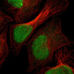 Invitrogen SPCS2 Polyclonal Antibody 100 &mu;L; Unconjugated:Antibodies,