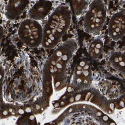 Invitrogen SPCS2 Polyclonal Antibody 100 &mu;L; Unconjugated:Antibodies,
