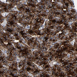 Invitrogen LRRC70 Polyclonal Antibody 100 &mu;L | Buy Online | Invitrogen&trade; | Fisher Scientific