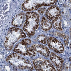 Invitrogen SNX19 Polyclonal Antibody 100 &mu;L; Unconjugated:Antibodies,