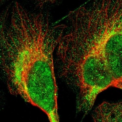 Invitrogen LRIT3 Polyclonal Antibody 100 &mu;L | Buy Online | Invitrogen&trade; | Fisher Scientific
