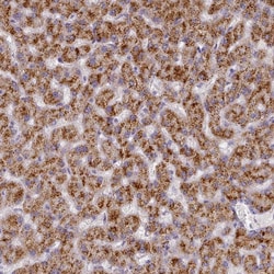 Invitrogen TYW1B Polyclonal Antibody 100 &mu;L; Unconjugated:Antibodies,