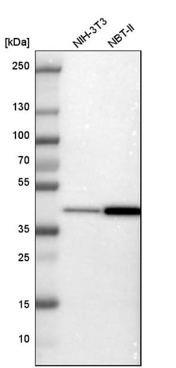 Invitrogen PREB Polyclonal Antibody 100 &mu;L; Unconjugated:Antibodies,