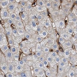 Invitrogen HIP1 Polyclonal Antibody 100 &mu;L; Unconjugated:Antibodies,