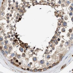 Invitrogen HIP1 Polyclonal Antibody 100 &mu;L; Unconjugated:Antibodies,