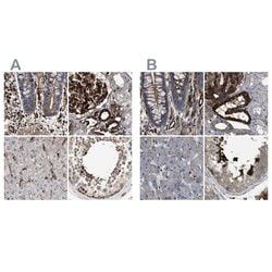 Invitrogen HIP1 Polyclonal Antibody 100 &mu;L; Unconjugated:Antibodies,