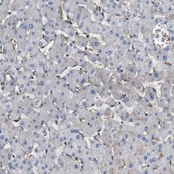 Invitrogen HIP1 Polyclonal Antibody 100 &mu;L; Unconjugated:Antibodies,
