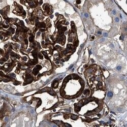 Invitrogen HIP1 Polyclonal Antibody 100 &mu;L; Unconjugated:Antibodies,