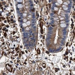 Invitrogen HIP1 Polyclonal Antibody 100 &mu;L; Unconjugated:Antibodies,