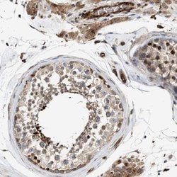 Invitrogen HIP1 Polyclonal Antibody 100 &mu;L; Unconjugated:Antibodies,