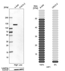 Invitrogen HIP1 Polyclonal Antibody 100 &mu;L; Unconjugated:Antibodies,