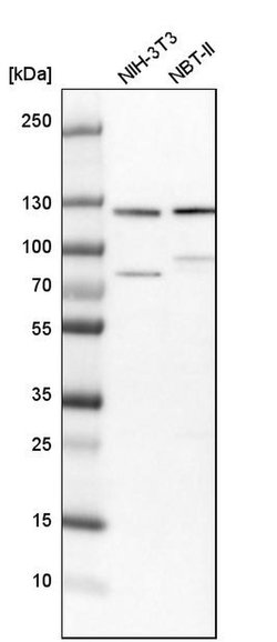 Invitrogen HIP1 Polyclonal Antibody 100 &mu;L; Unconjugated:Antibodies,