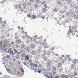 Invitrogen C16orf89 Polyclonal Antibody 100 &mu;L; Unconjugated:Antibodies,