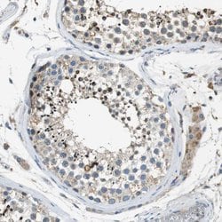 Invitrogen MAGI2 Polyclonal Antibody 100 &mu;L; Unconjugated:Antibodies,