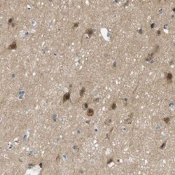 Invitrogen MAGI2 Polyclonal Antibody 100 &mu;L; Unconjugated:Antibodies,