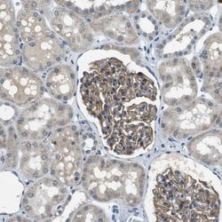 Invitrogen MAGI2 Polyclonal Antibody 100 &mu;L; Unconjugated:Antibodies,