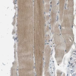 Invitrogen MAGI2 Polyclonal Antibody 100 &mu;L; Unconjugated:Antibodies,