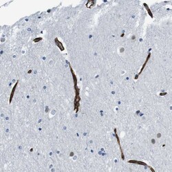 Invitrogen HSPA12B Polyclonal Antibody 100 &mu;L; Unconjugated:Antibodies,
