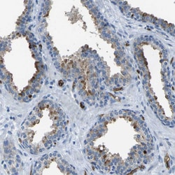 Invitrogen HSPA12B Polyclonal Antibody 100 &mu;L; Unconjugated:Antibodies,