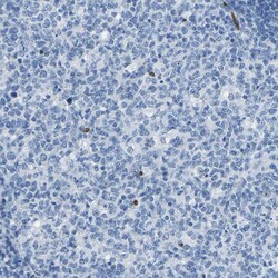 Invitrogen HSPA12B Polyclonal Antibody 100 &mu;L; Unconjugated:Antibodies,