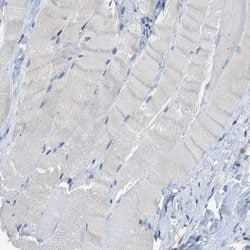 Invitrogen SLCO2A1 Polyclonal Antibody 100 &mu;L; Unconjugated:Antibodies,