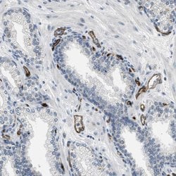 Invitrogen SLCO2A1 Polyclonal Antibody 100 &mu;L; Unconjugated:Antibodies,