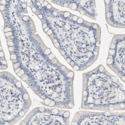 Invitrogen FMO3 Polyclonal Antibody 100 &mu;L; Unconjugated:Antibodies,