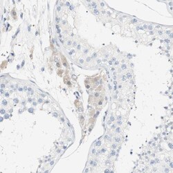 Invitrogen FMO3 Polyclonal Antibody 100 &mu;L; Unconjugated:Antibodies,