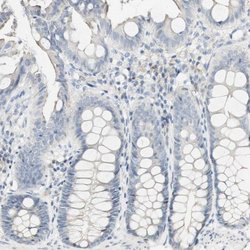 Invitrogen FMO3 Polyclonal Antibody 100 &mu;L; Unconjugated:Antibodies,