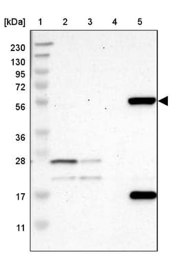 Invitrogen FMO3 Polyclonal Antibody 100 &mu;L; Unconjugated:Antibodies,