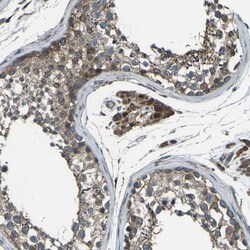 Invitrogen LSMEM1 Polyclonal Antibody 100 &mu;L; Unconjugated:Antibodies,