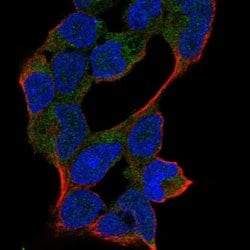 Invitrogen ANKRD46 Polyclonal Antibody 100 &mu;L; Unconjugated:Antibodies,