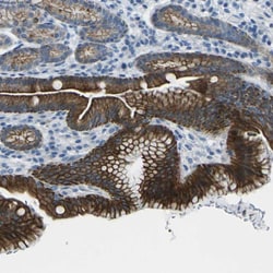 Invitrogen ANKRD46 Polyclonal Antibody 100 &mu;L; Unconjugated:Antibodies,