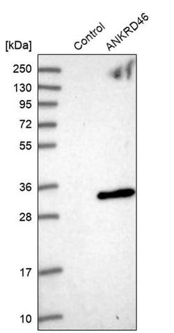 Invitrogen ANKRD46 Polyclonal Antibody 100 &mu;L; Unconjugated:Antibodies,
