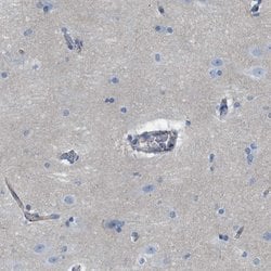 CRB3 Polyclonal Antibody, Invitrogen 100 &mu;L; Unconjugated:Antibodies,