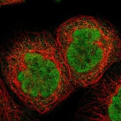Invitrogen TIAM2 Polyclonal Antibody 100 &mu;L; Unconjugated:Antibodies,