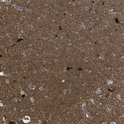 Invitrogen TIAM2 Polyclonal Antibody 100 &mu;L; Unconjugated:Antibodies,