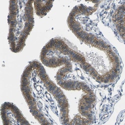 Invitrogen RHBDD1 Polyclonal Antibody 100 &mu;L; Unconjugated:Antibodies,