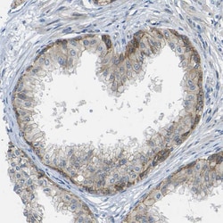 Invitrogen RHBDD1 Polyclonal Antibody 100 &mu;L; Unconjugated:Antibodies,